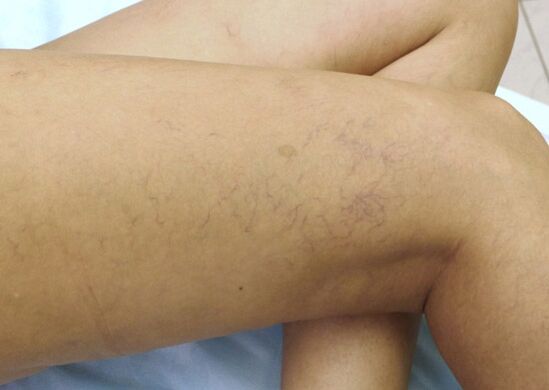 Съдови звезди