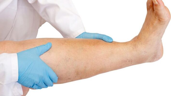 как да разпознаем болестта